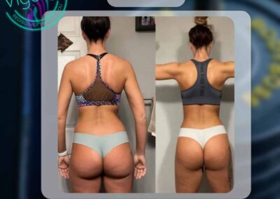 Client Testimonial Template for Feed - 2